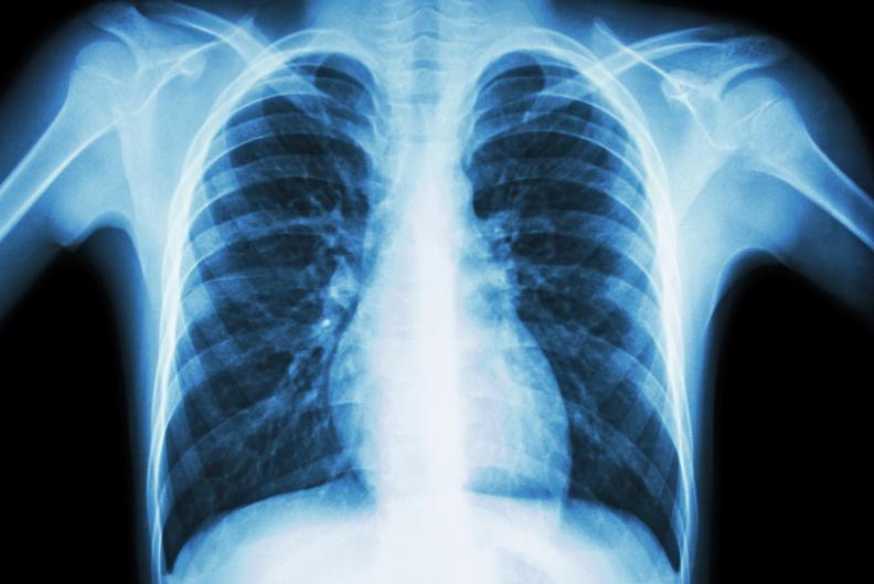 HWS Medizin Röntgenkurs Extremitäten Thorax